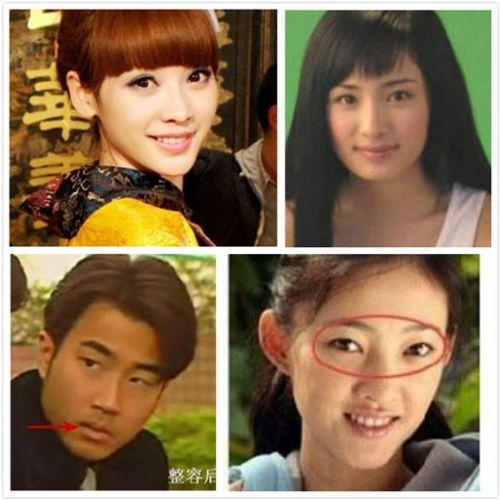 整容失敗的女明星，背后的故事與教訓(xùn)，整容失敗的女明星背后的故事與教訓(xùn)揭秘